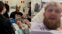 Джейк Пол перенес вторую операцию на сломанной челюсти