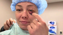 Роуз Намаюнас сообщила об операции на глазе