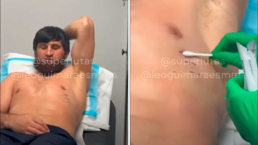 Магомед Анкалаев вышел на бой против Алекса Перейры с травмой ребра