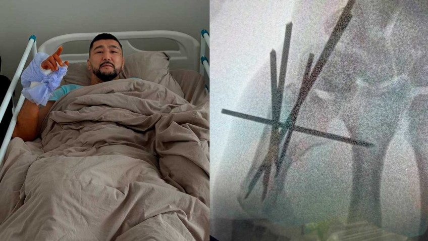 Ильясу Хамзину прооперировали руку