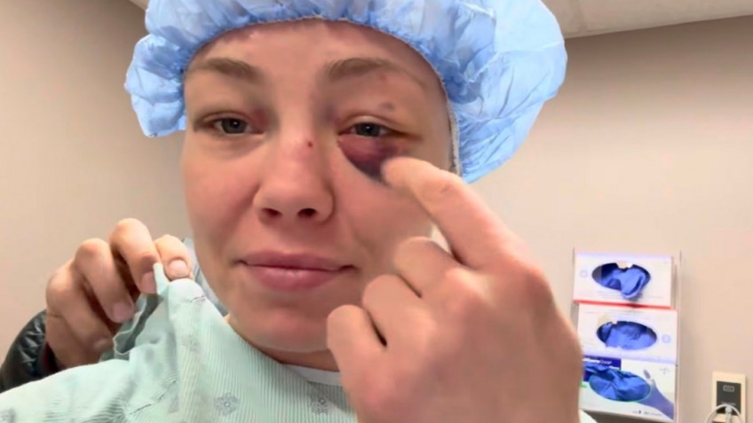 Роуз Намаюнас сообщила об операции на глазе