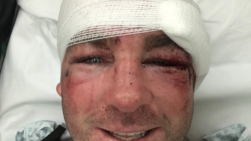 Лукас Браун: У меня все в порядке, я еще вернусь