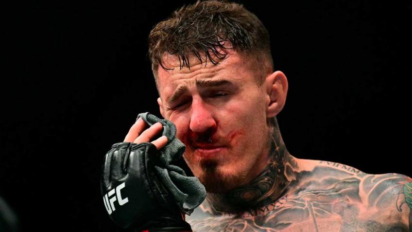 Том Аспинэлл рассказал о травме глаза, пообещал отомстить Сирилу Гану