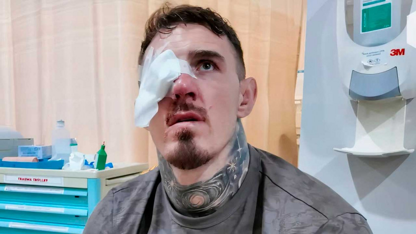 Том Аспинэлл вернется в октагон не раньше осени